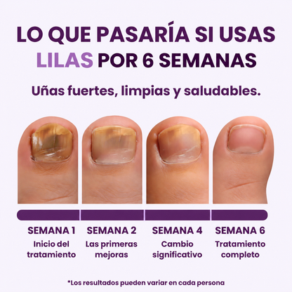 2x1 en Parches Antihongos Nocturno para las Uñas
